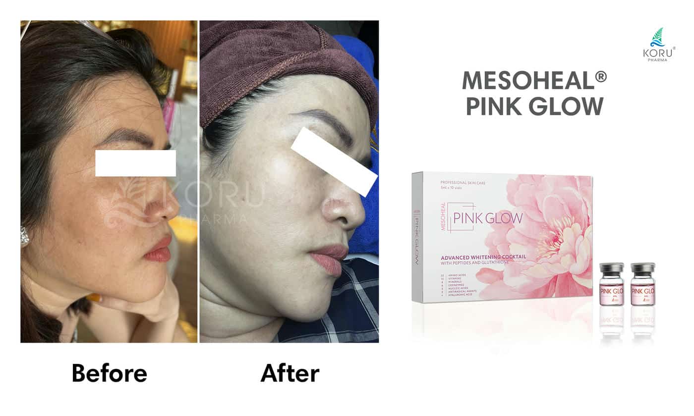 Pink Glow - Image 4