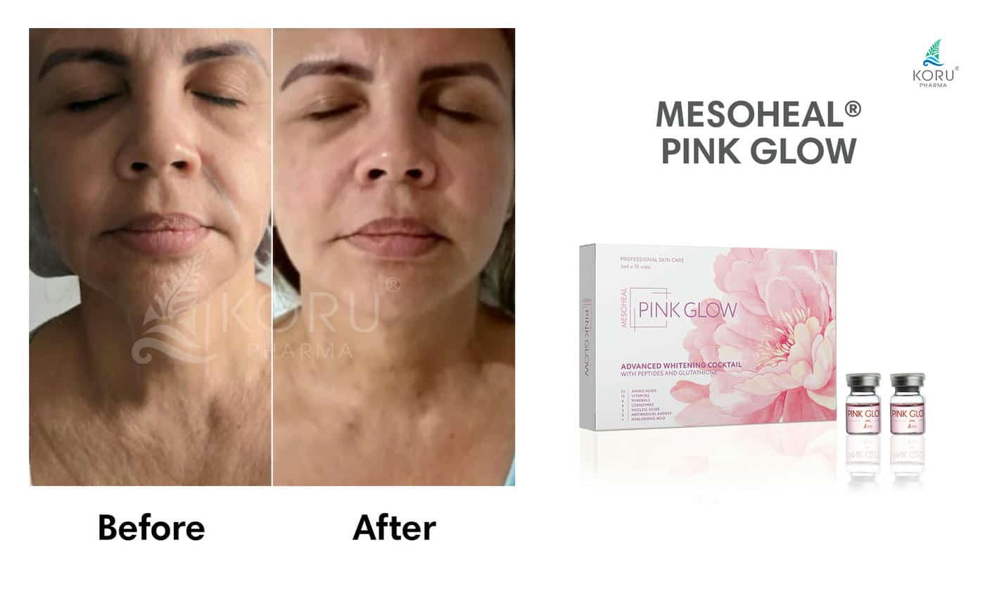 Pink Glow - Image 19