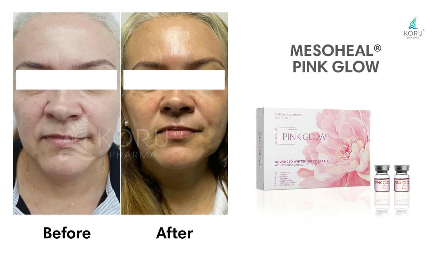 Pink Glow - Image 13