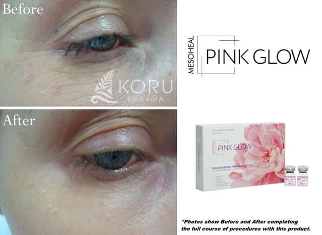 Pink Glow - Image 17